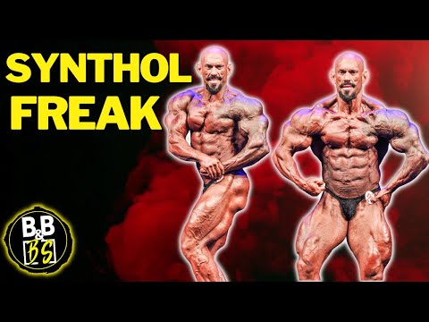 Synthol RUINED His Physique – Abused EVERYWHERE