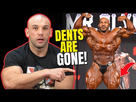 Big Ramy's  Quads Are FIXED!